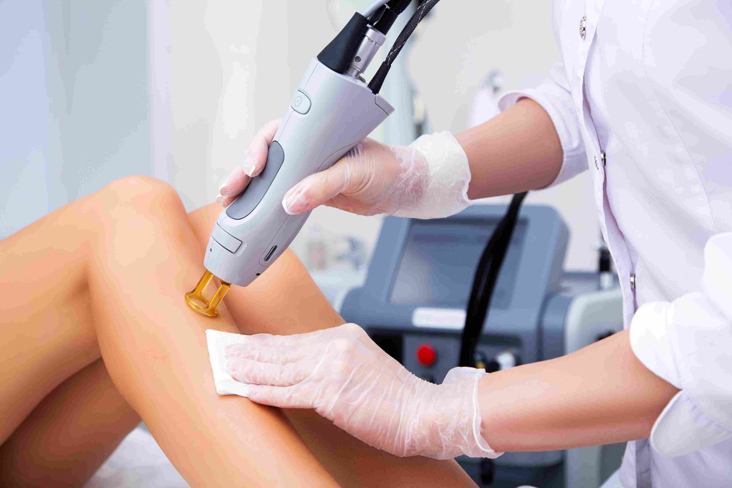 Laser Hair Removal treatment